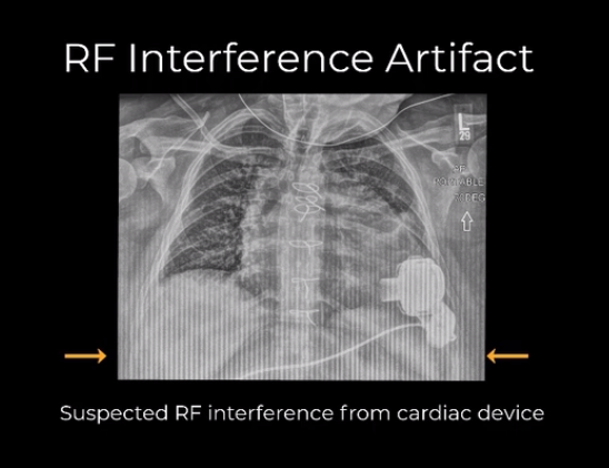 RF Interference – Case 1